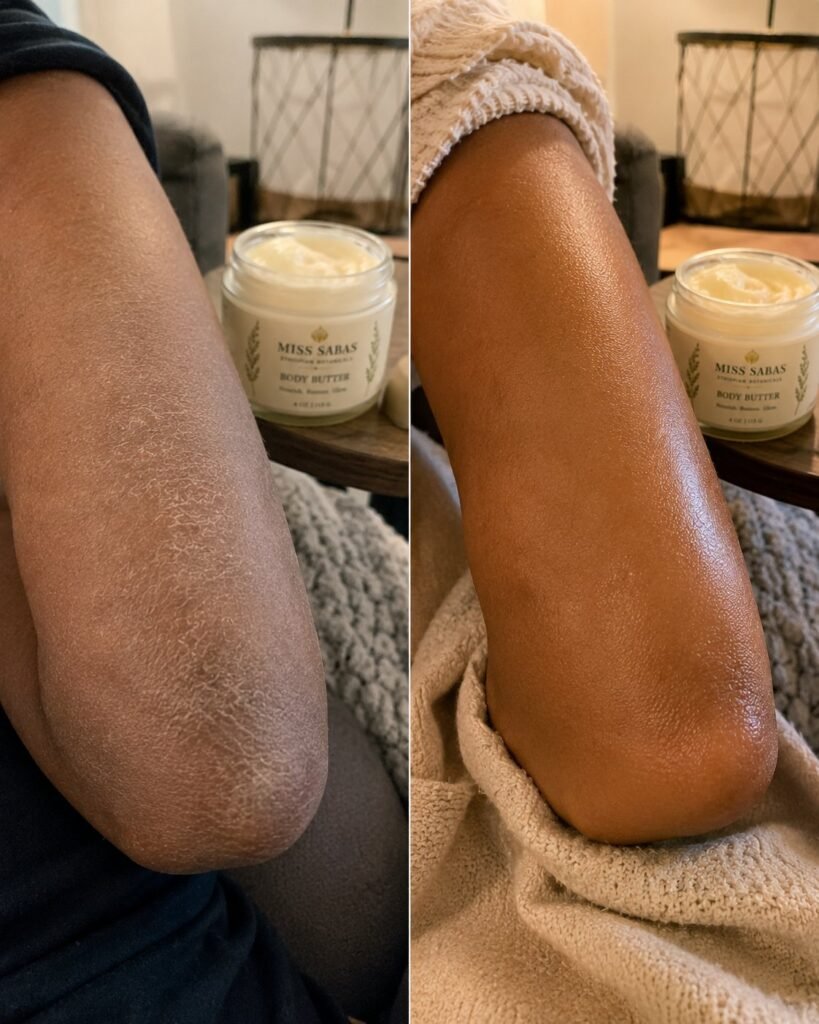 Body Butter before and after, in real life